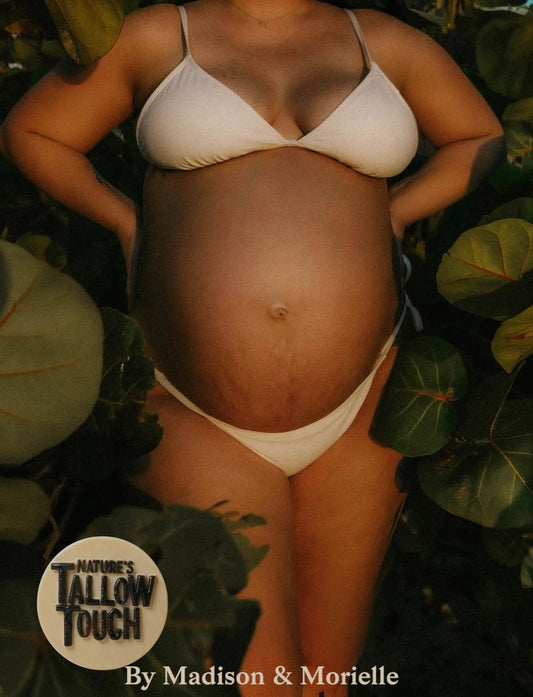 Post-Shower Body Comfort: A Calm Ritual for Stretch-Mark-Prone Areas