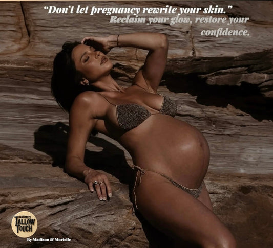 Stretch, But Never Settle — Luxe Mother’s Recovery Body Cream