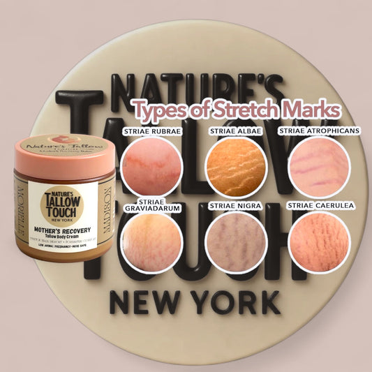 The 5-Minute Ritual for Stretch-Mark-Prone Skin (That Won’t Stick to Your Clothes)