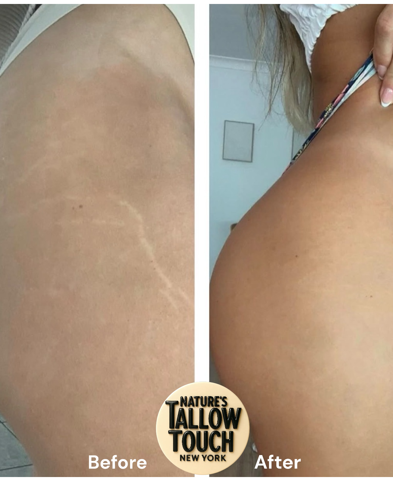 Mother’s Recovery Tallow Body Cream | Dry Skin-Elasticity + Stretch-Mark & Discoloration support - Nature’s Tallow Touch LLC