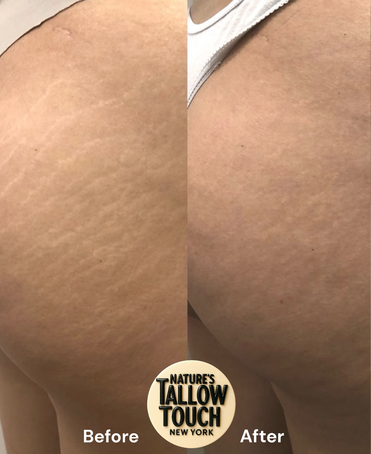 Mother’s Recovery Tallow Body Cream | Dry Skin-Elasticity + Stretch-Mark & Discoloration support - Nature’s Tallow Touch LLC