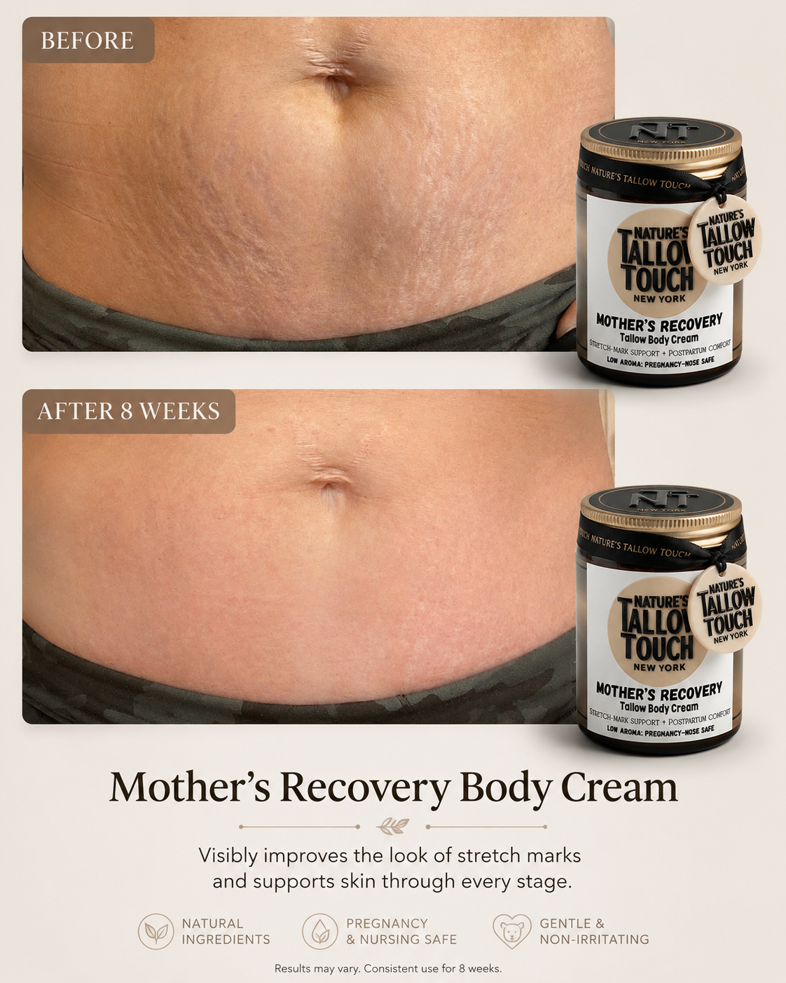 Mother’s Recovery Tallow Body Cream — Made for Stretching, Dry, Changing Skin. - Nature’s Tallow Touch LLC