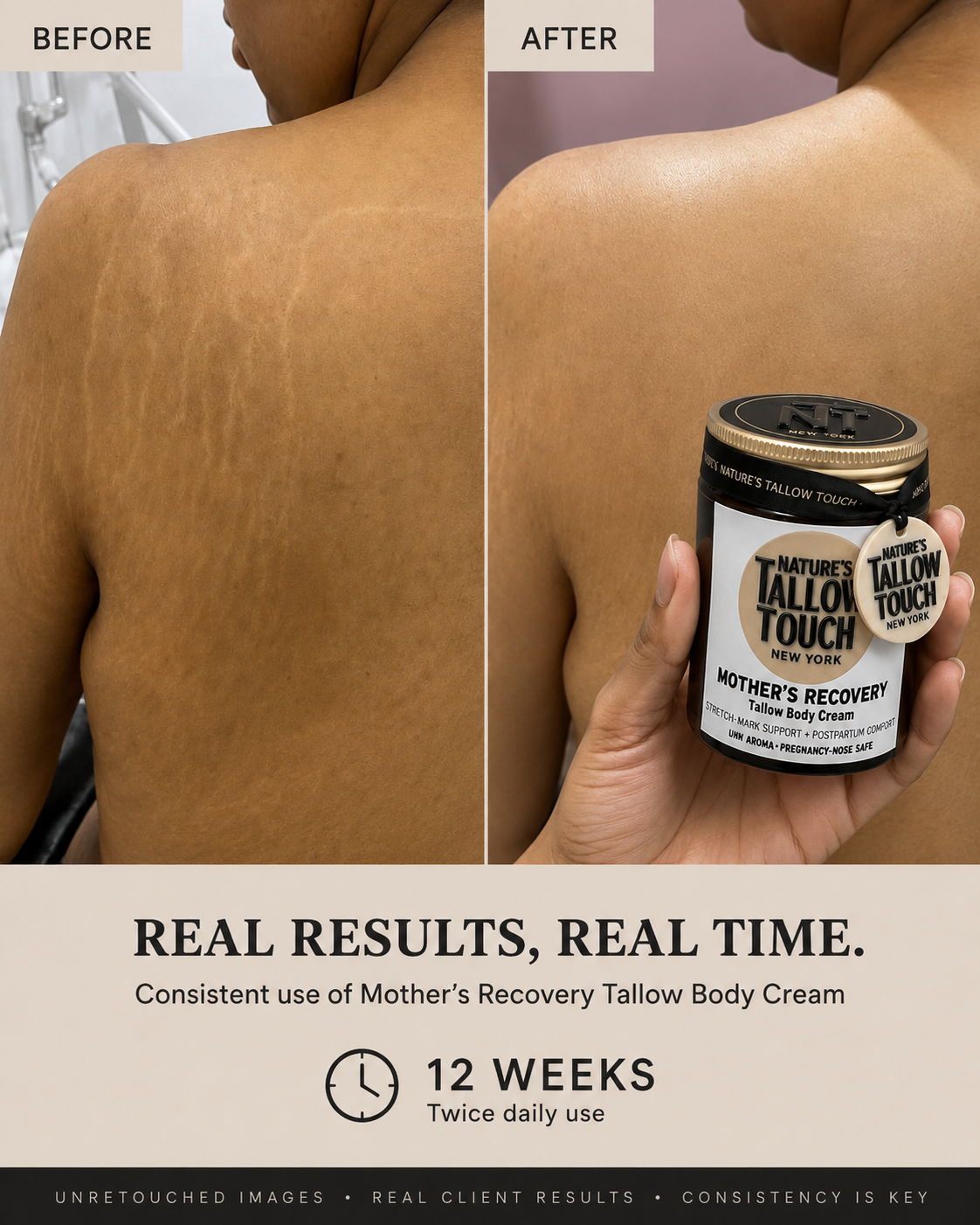 Mother’s Recovery Tallow Body Cream — Made for Stretching, Dry, Changing Skin. - Nature’s Tallow Touch LLC