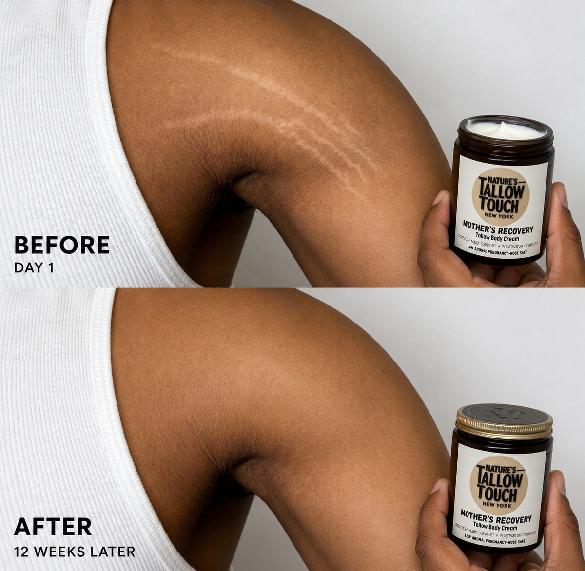 Mother’s Recovery Tallow Body Cream — Made for Stretching, Dry, Changing Skin. - Nature’s Tallow Touch LLC