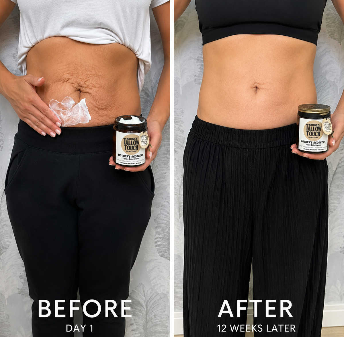 Mother’s Recovery Tallow Body Cream — Made for Stretching, Dry, Changing Skin. - Nature’s Tallow Touch LLC