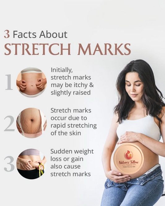 Mother’s Recovery Tallow Body Cream | Skin-Elasticity + Stretch-Mark support + Postpartum comfort (Leave-On Body Care)