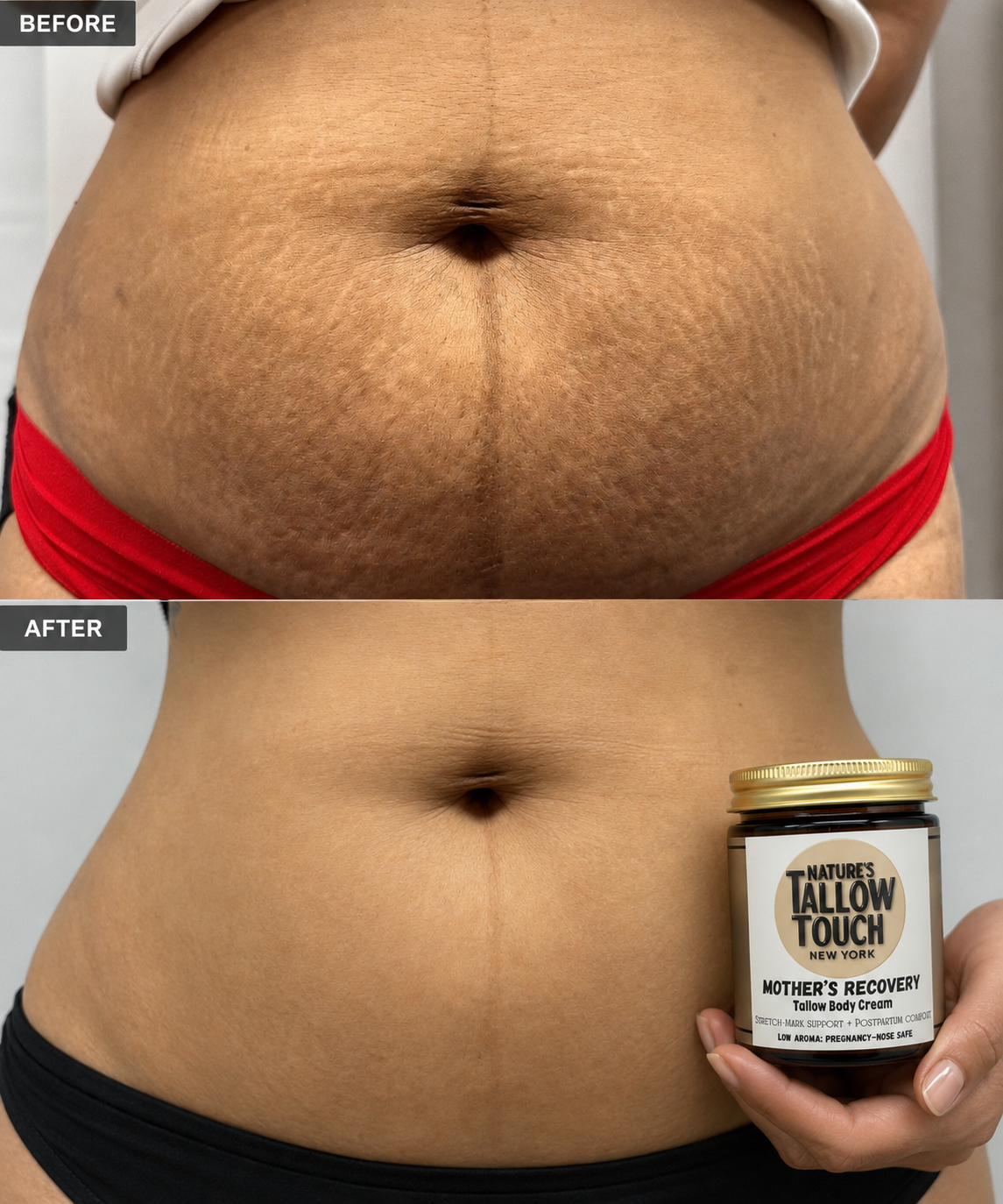 Mother’s Recovery Tallow Body Cream — Made for Stretching, Dry, Changing Skin.