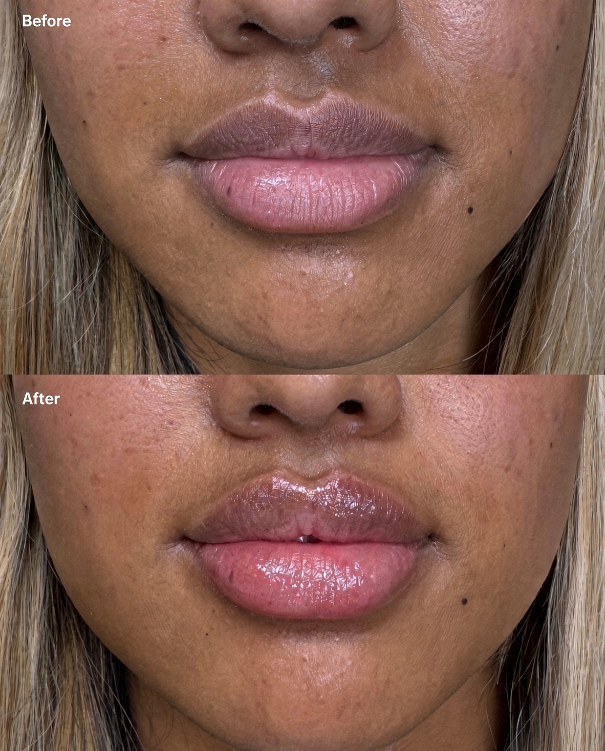 Lip Brightening Tallow Balm — Daily Moisture for Dryness, Dullness + Uneven-Tone Support. - Nature’s Tallow Touch LLC